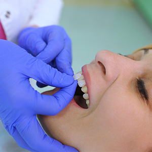 Granger Dentistry | Dental Fillings, VELscope reg Cancer Screening and Cosmetic Dentistry